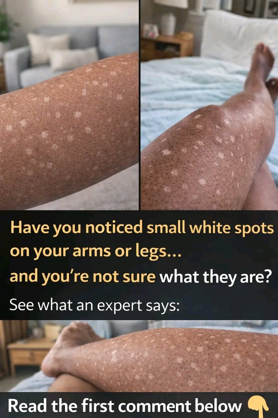 Have you noticed small white spots on your arms or legs and don’t know what they are?