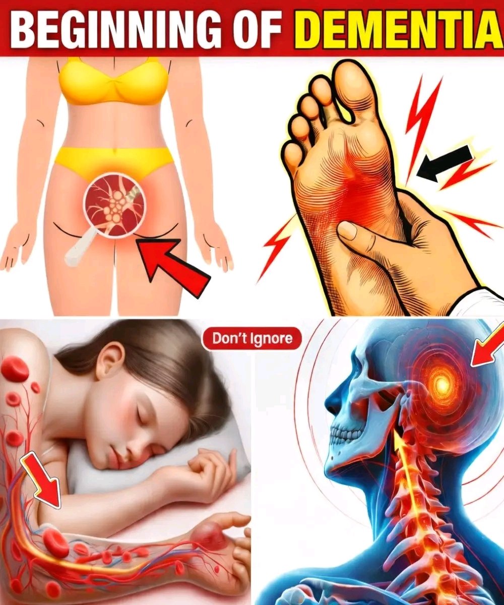 🧠 10 Shocking Signs of Dementia Most People Overlook — Watch Before It’s Too Late