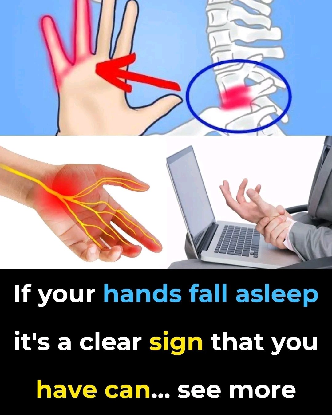 If your HANDS fall asleep it’s a clear sign that you have can… see mor