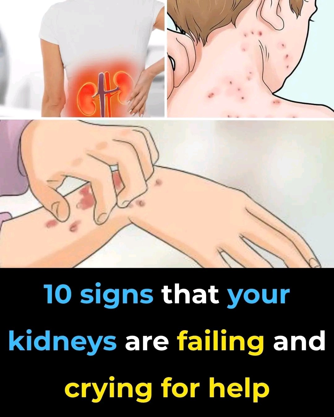 If your kidneys aren’t working properly, your body often gives warning signs.