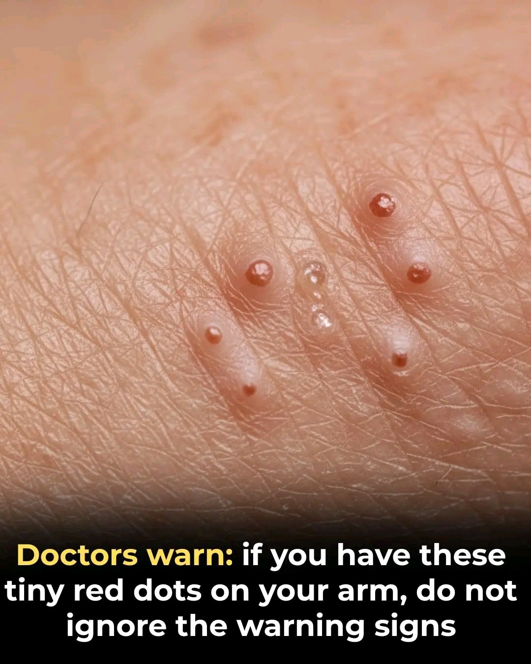 🚨 Doctors warn: if you notice tiny red dots on your arm or hand, do not ignore them