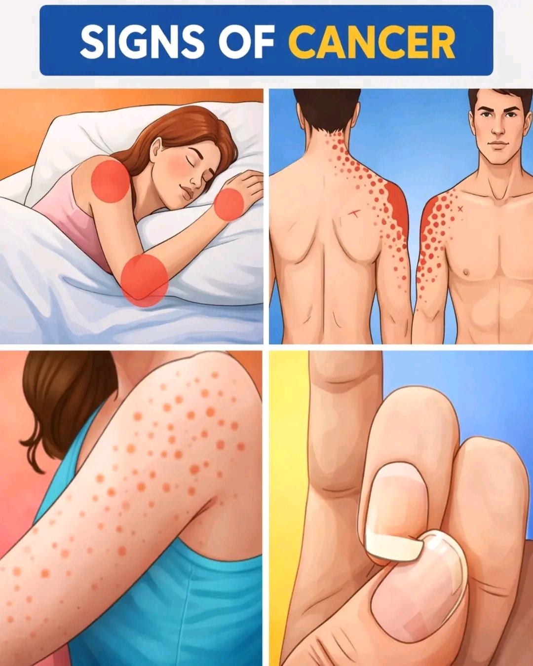 🚨 10 Common and Overlooked Signs of CANCER – Watch Before It’s Too Late