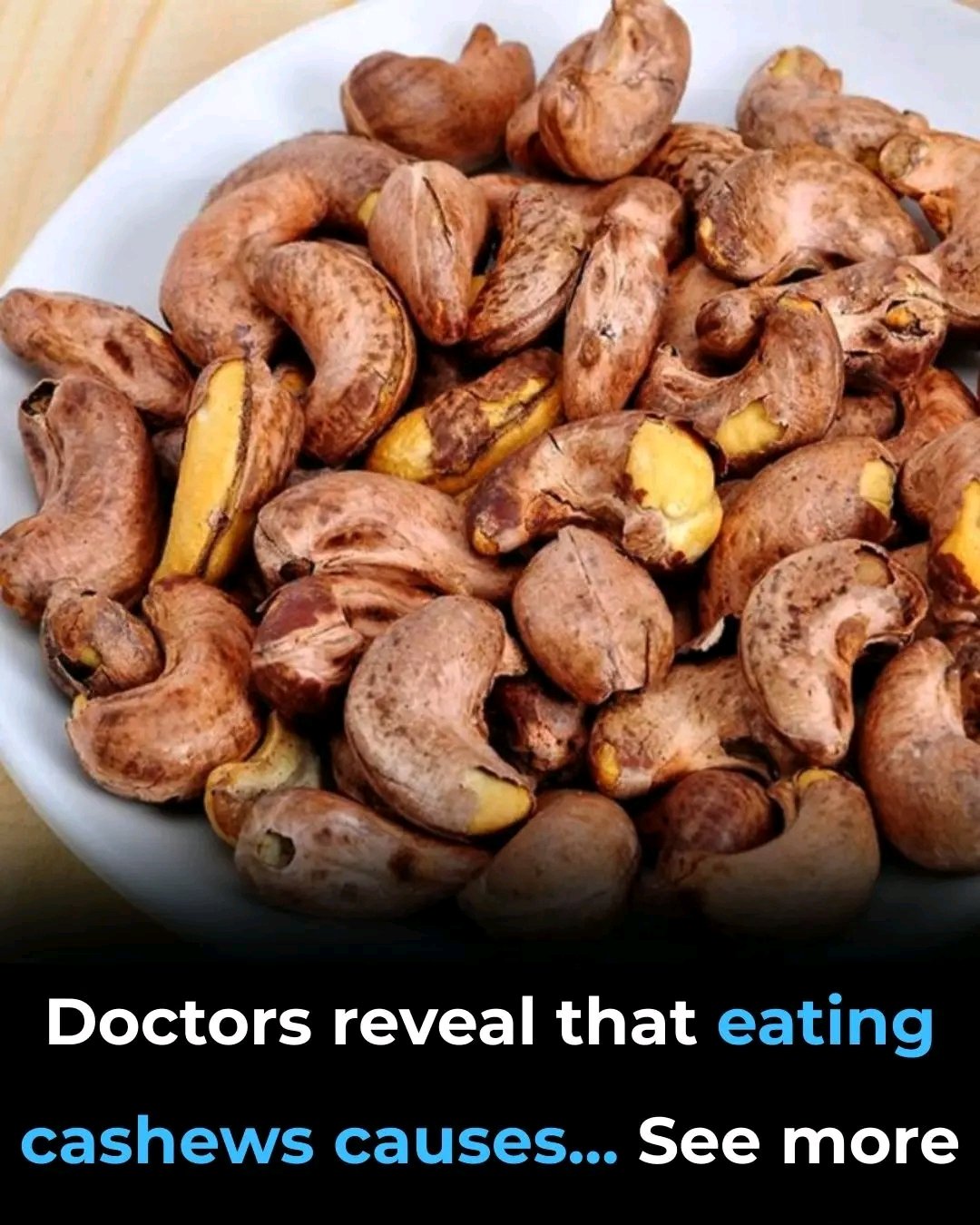🥜 Doctors reveal that eating cashews causes… (the truth behind the headline)