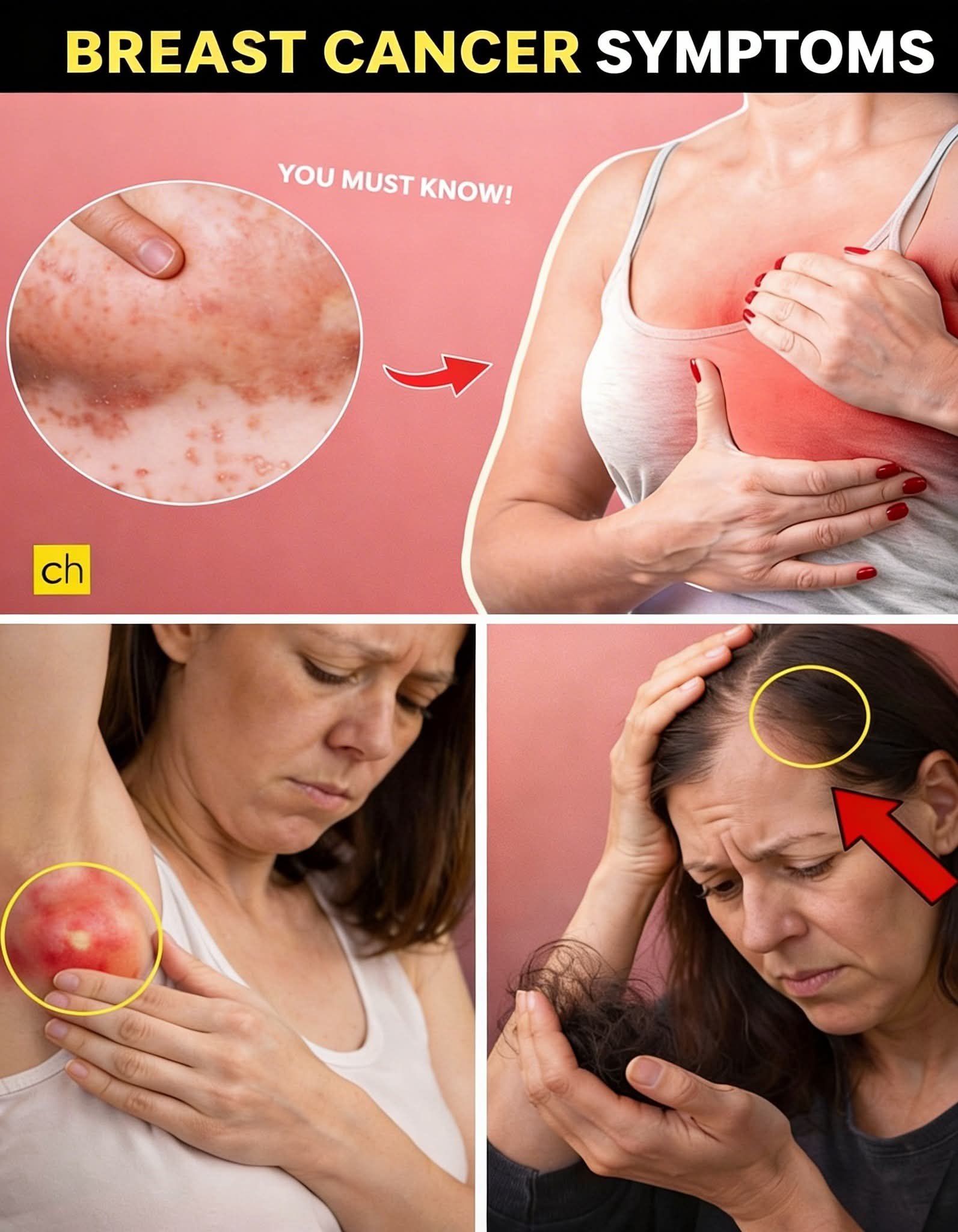 🎗️ 10 Warning Signs and Symptoms of Breast Cancer