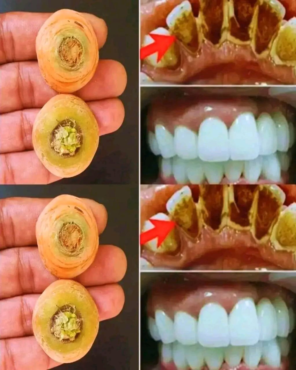 😁🥕 Whiten Teeth Like Pearls in 2 Minutes with This “Carrot-Top” Remedy — Truth you should know first