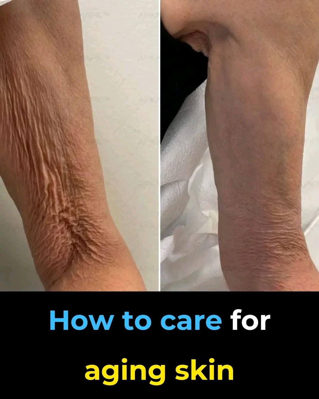 How to care for aging skin ….see more