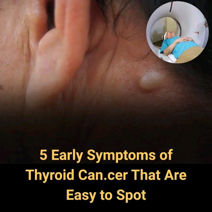 5 Warning Signs of Thyroid Cancer You Shouldn’t Ignore