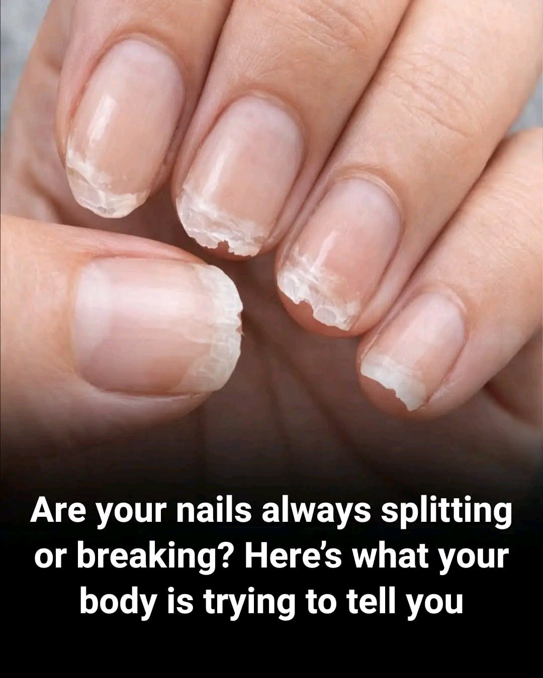 Brittle or weak nails may signal several underlying issues related to health,