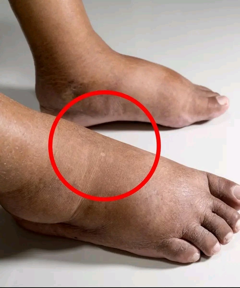 A Doctor Breaks Down 10 Common Causes of Swelling in the Feet and Ankles 🦶