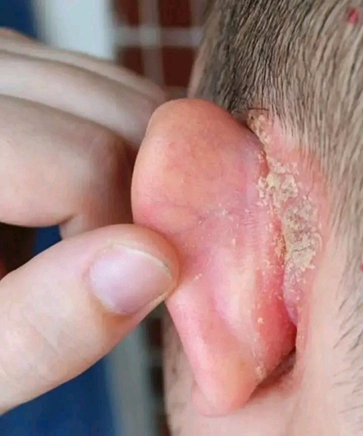 Common Causes of a Spot on the Ear