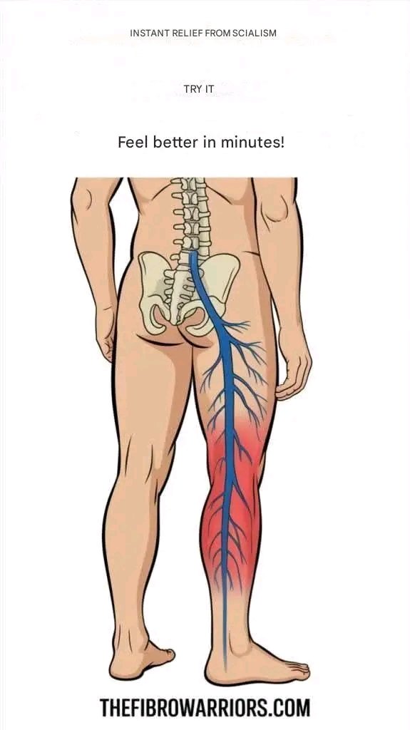 Instant Sciatica Pain Relief: Try It and Feel Better in Minutes! ⚡
