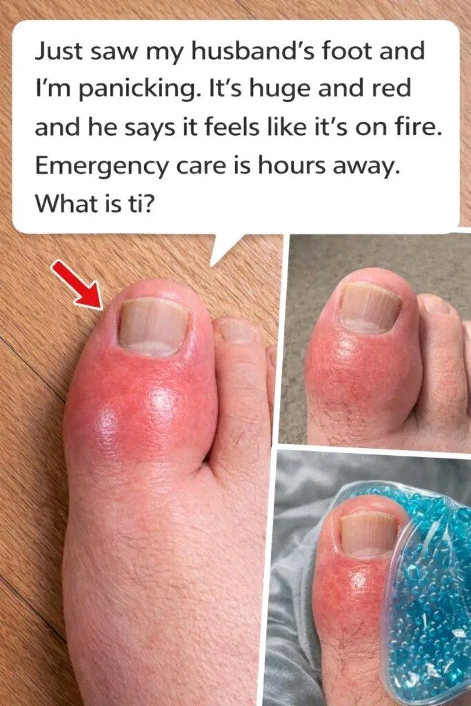 What Does It Mean If Your Foot Suddenly Becomes Red, Swollen, and Feels Like It’s Burning? 🔥🦶