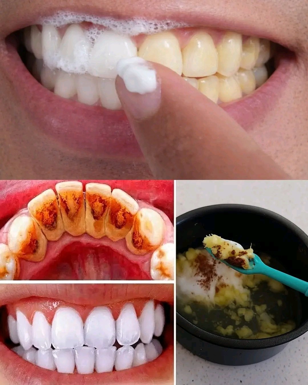 How to whiten yellow teeth at home.