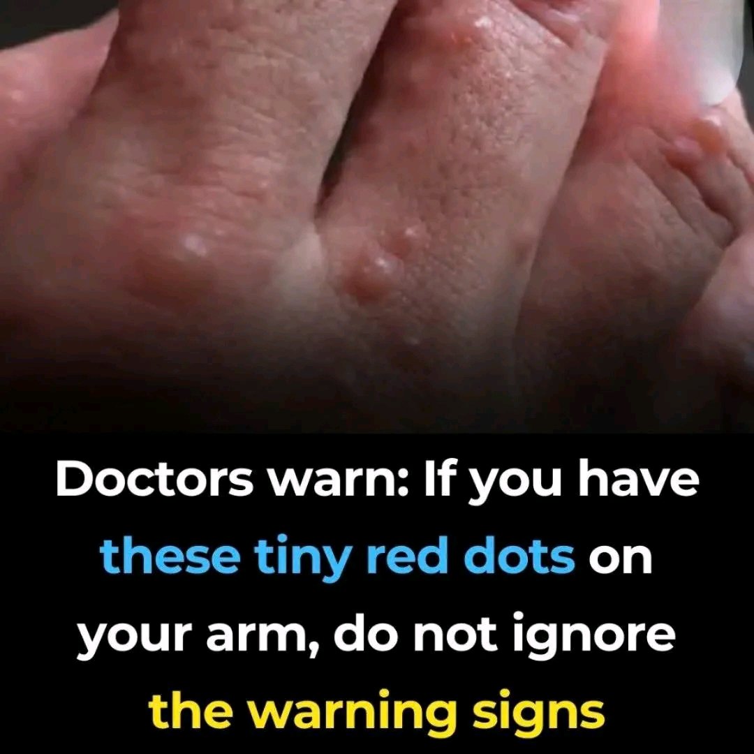 Doctors Warn: If You Have These Tiny Red Dots on Your Arms or Hands, Don’t Ignore Them 🚨
