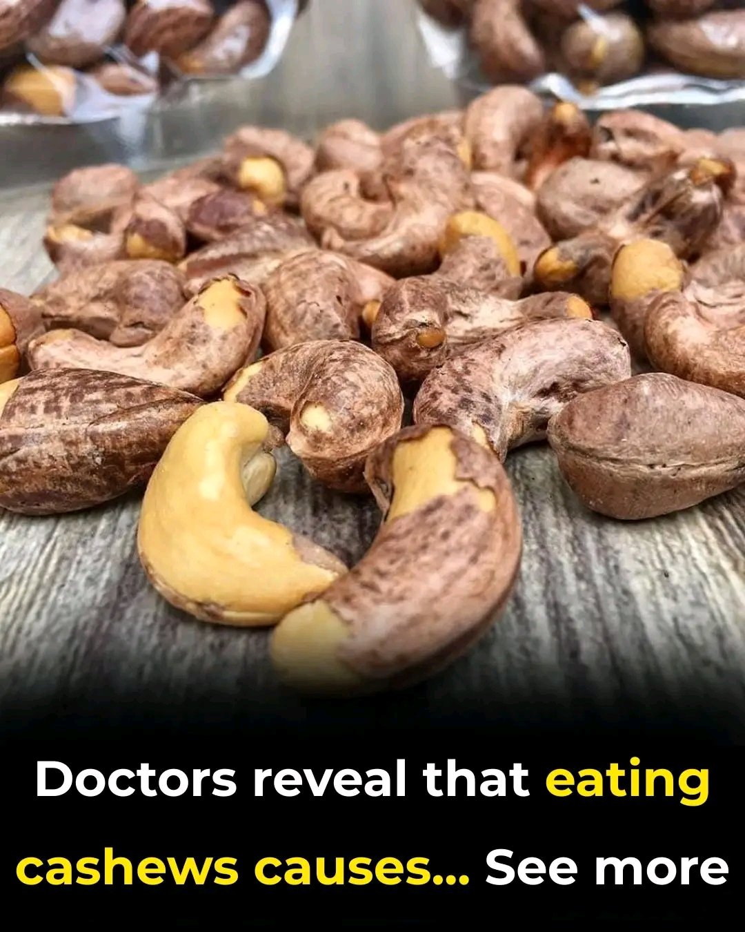 🥜 Doctors Reveal What Eating Cashews Can Do to Your Body