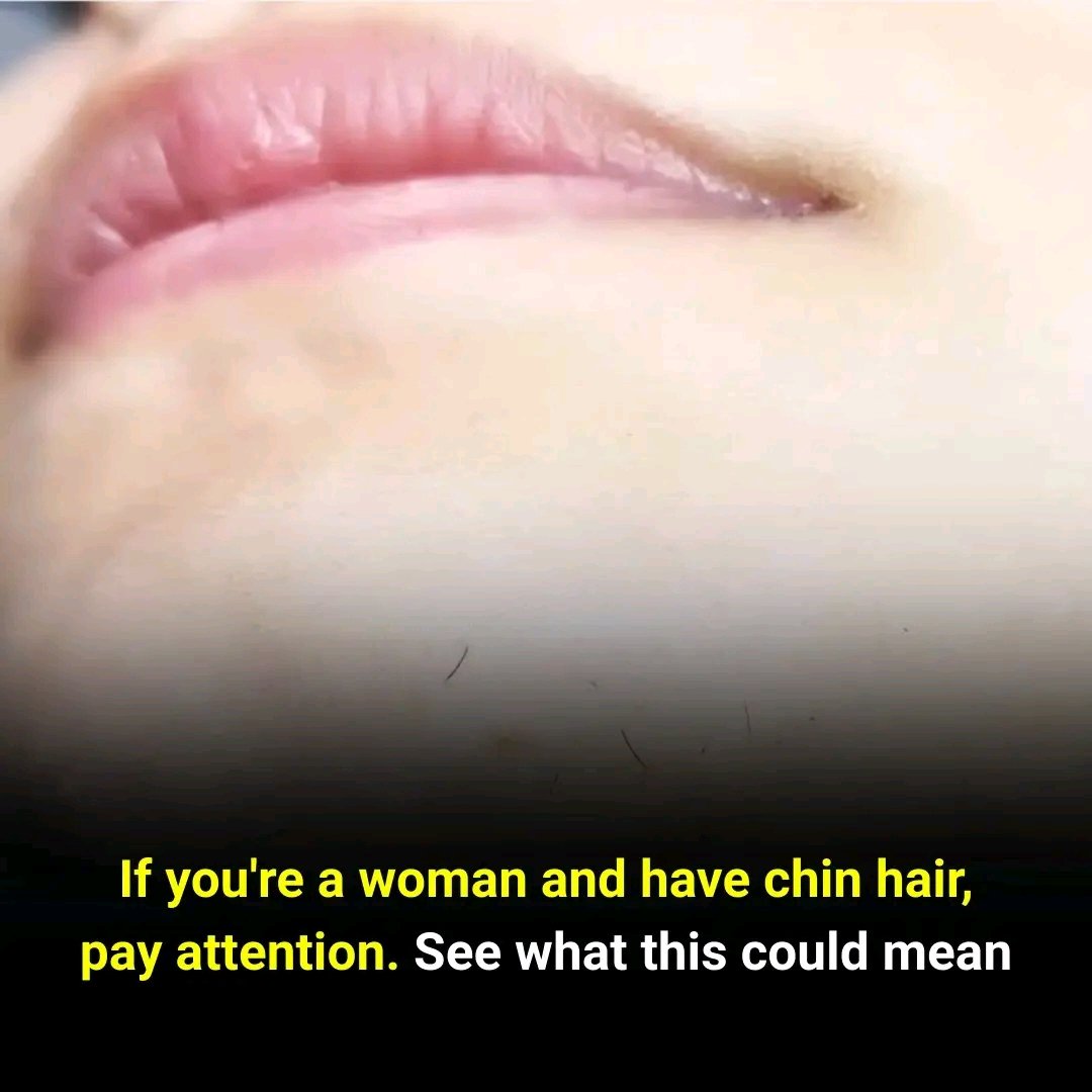 ⚠️ Chin Hair in Women: What Your Body Might Be Telling You