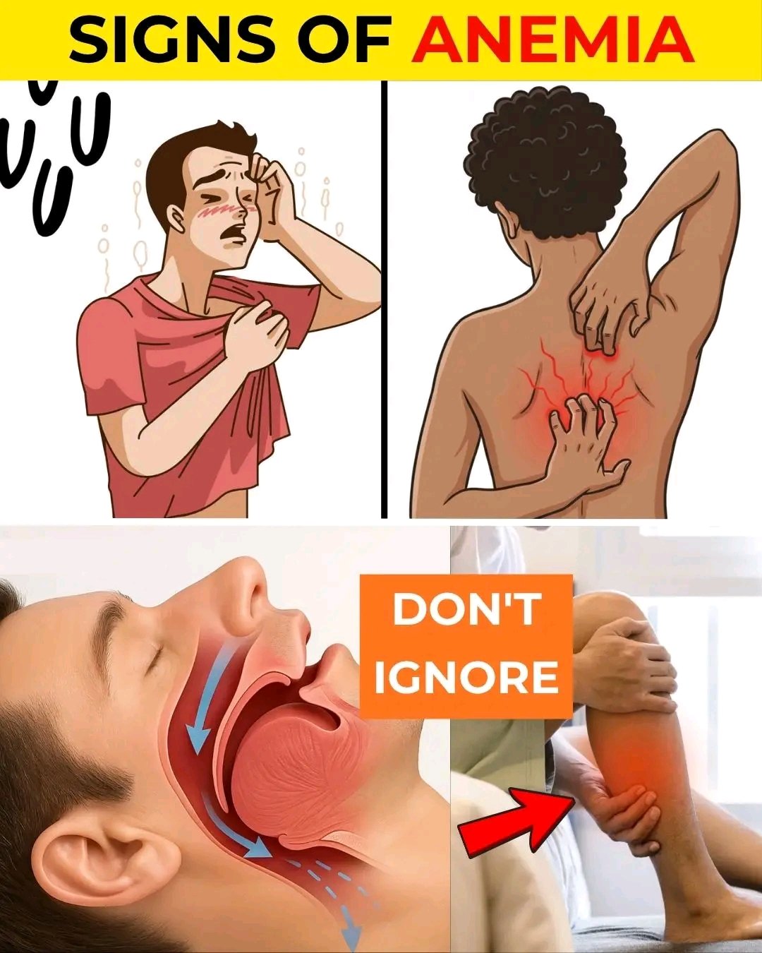 🩸 Silent Symptoms of Anemia You Should Never Ignore