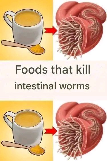 🦠 7 Foods That May Help Fight Intestinal Worms Naturally