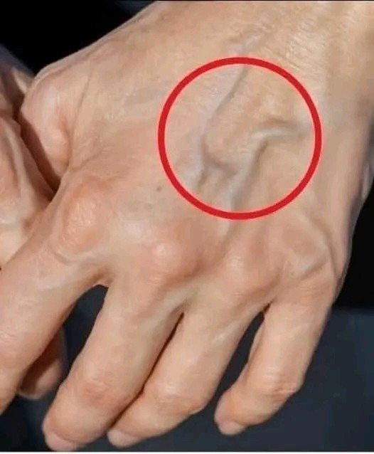 If You Have Visible Veins, It Could Be a Sign of These Things… See More 👇