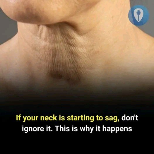 ⚠️ If Your Neck Is Starting to Sag, Don’t Ignore It — This Is Why It Happens