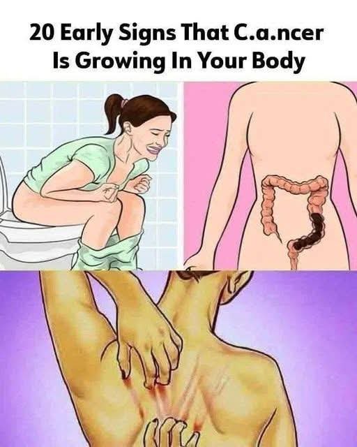 🚨 20 Early Warning Signs That Cancer May Be Growing in Your Body