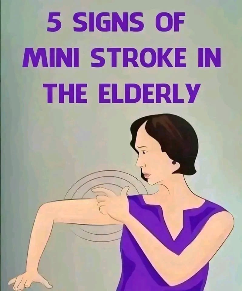 5 Signs of a Mini Stroke in the Elderly ⚠️