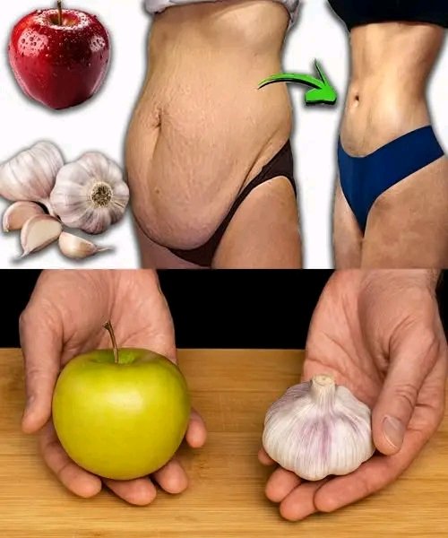 Apple and Garlic Mix: The Truth Behind This “Slimming Secret “
