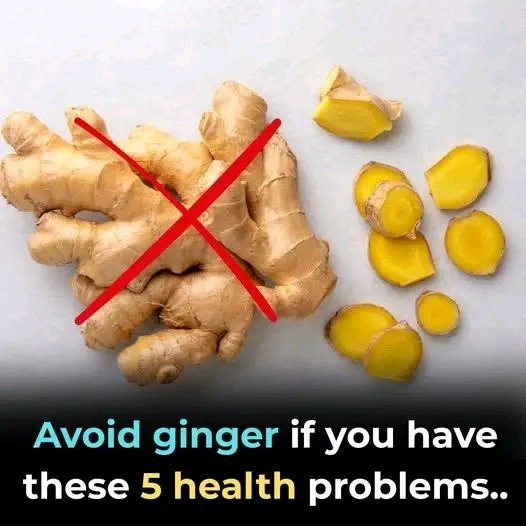 Doctors Say That Eating Ginger May Lead to Surprising Health Benefits 🌿
