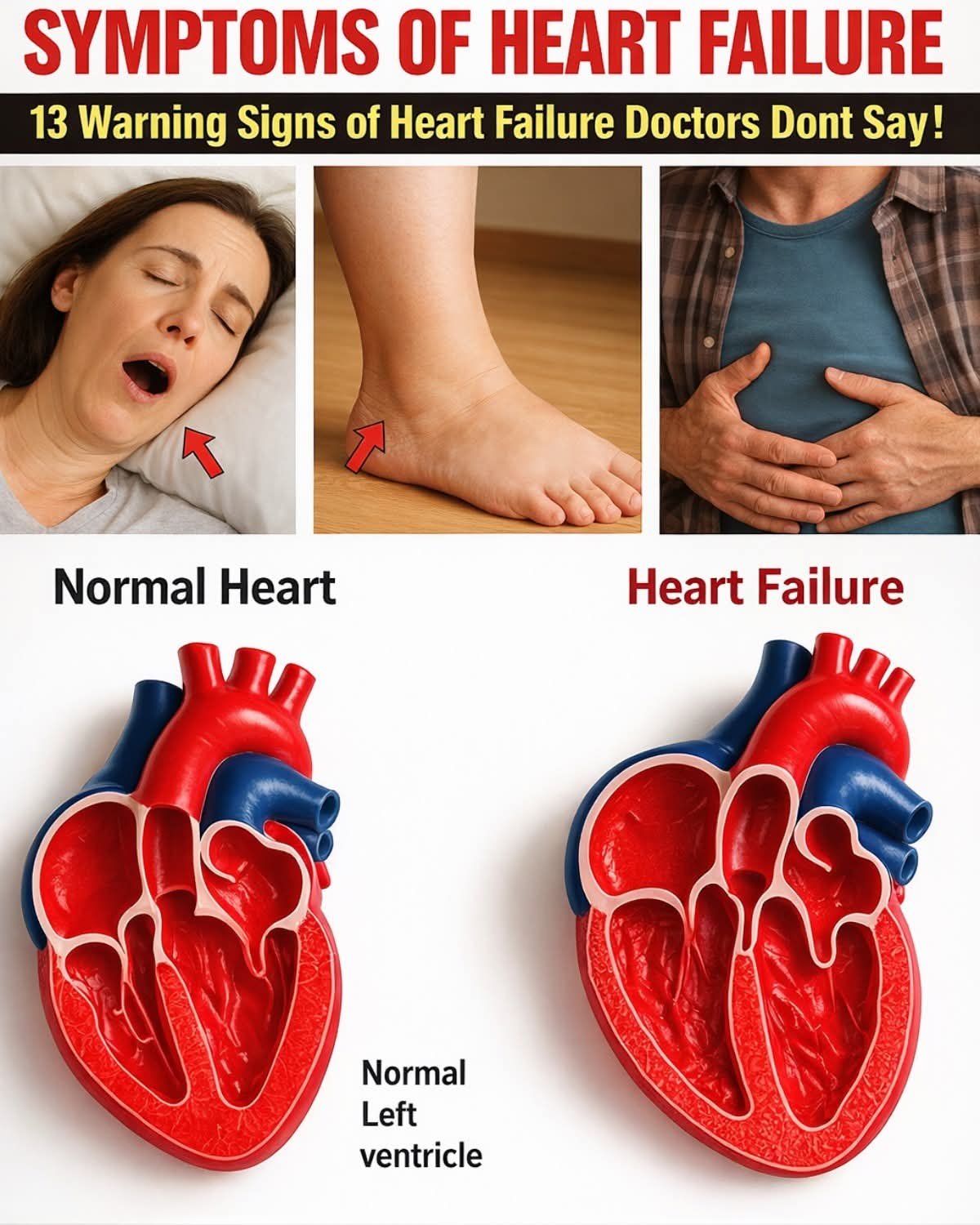 ❤️ 13 Early Signs of Heart Failure You Should Never Ignore 😨