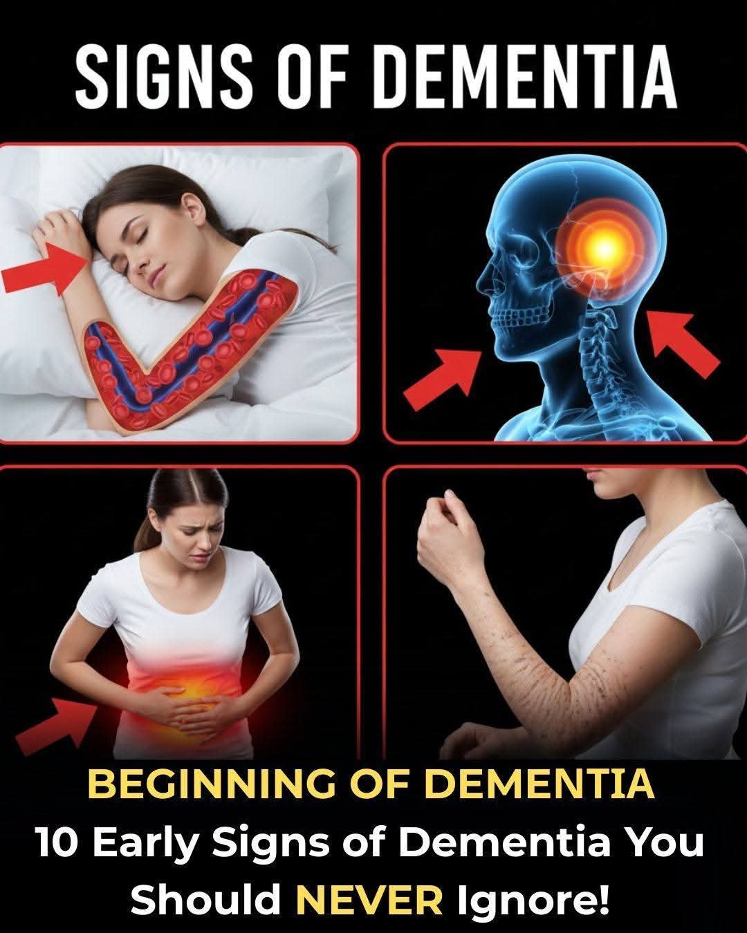 🧠 10 Early Signs of Dementia You Should NEVER Ignore