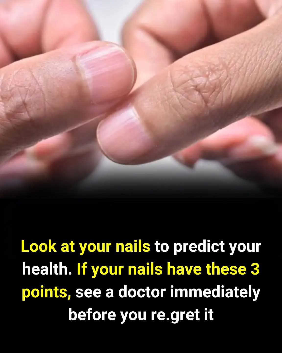 💅 How to Spot Health Issues by Looking at Your Nails 😲