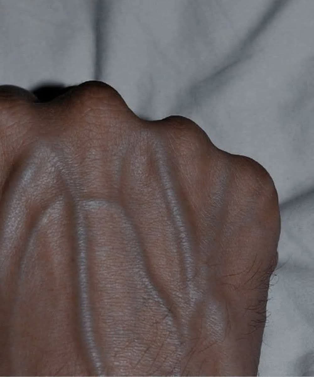 🤔 Visible Veins in Your Hands — What Do They Really Mean?