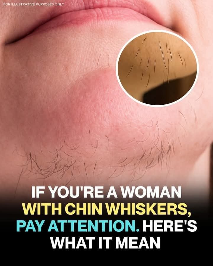 If You’re a Woman With Chin Whiskers, Here’s What It Actually Means