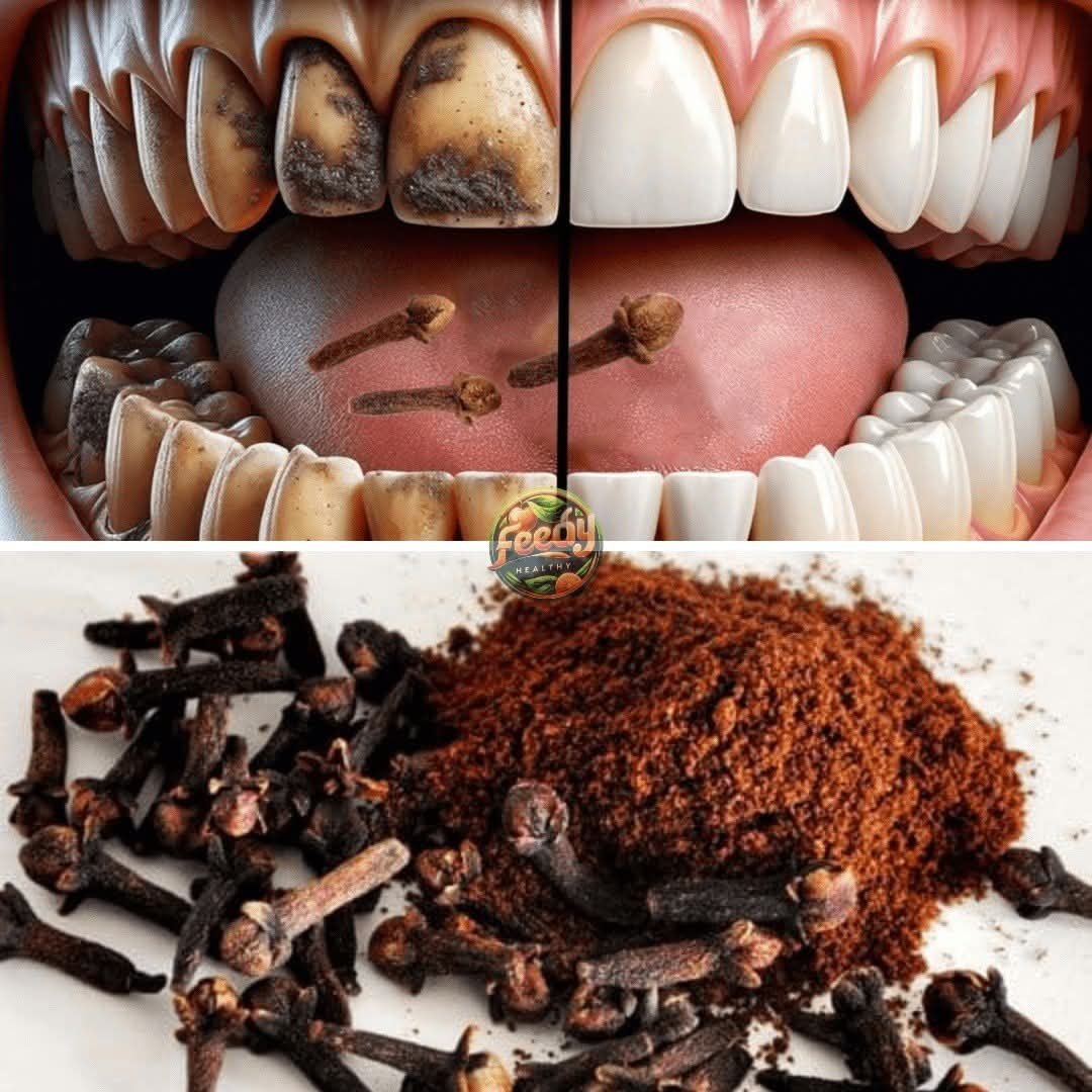 🌿🦷 Cloves – the Natural Secret to Better Oral Health & Immunity 🦷🌿