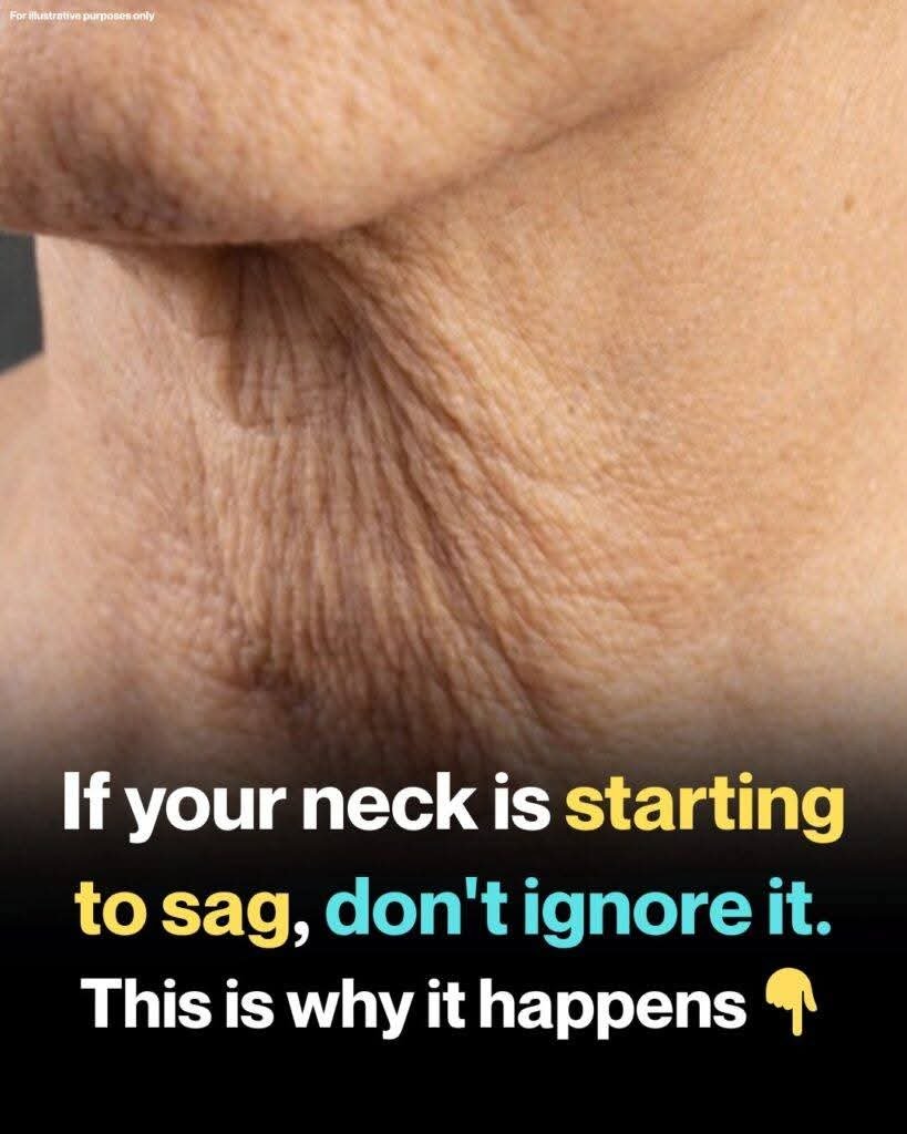 🧓 Why Neck Skin Sags as You Age — And What You Can Do About It