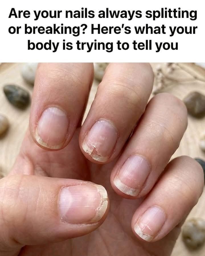 Brittle Nails? 10 Hidden Causes Your Body Is Trying to Tell You About — And How to Fix Them Fast
