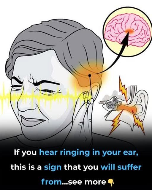 Ringing in Your Ears? Here’s What It Could Really Mean 👂