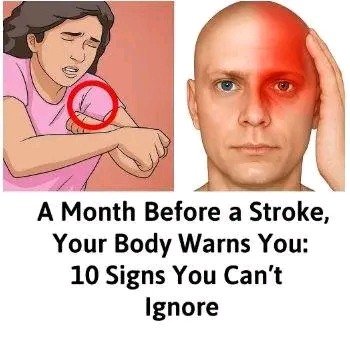 A Month Before a Stroke, Your Body Warns You: 10 Signs Not to Ignore
