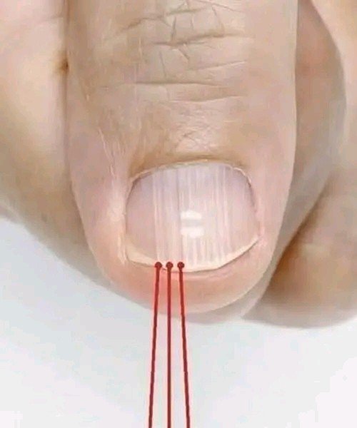 If You Have These Lines on Your Nails After 40, It Could Be a Sign That Your Body Needs Attention 👇
